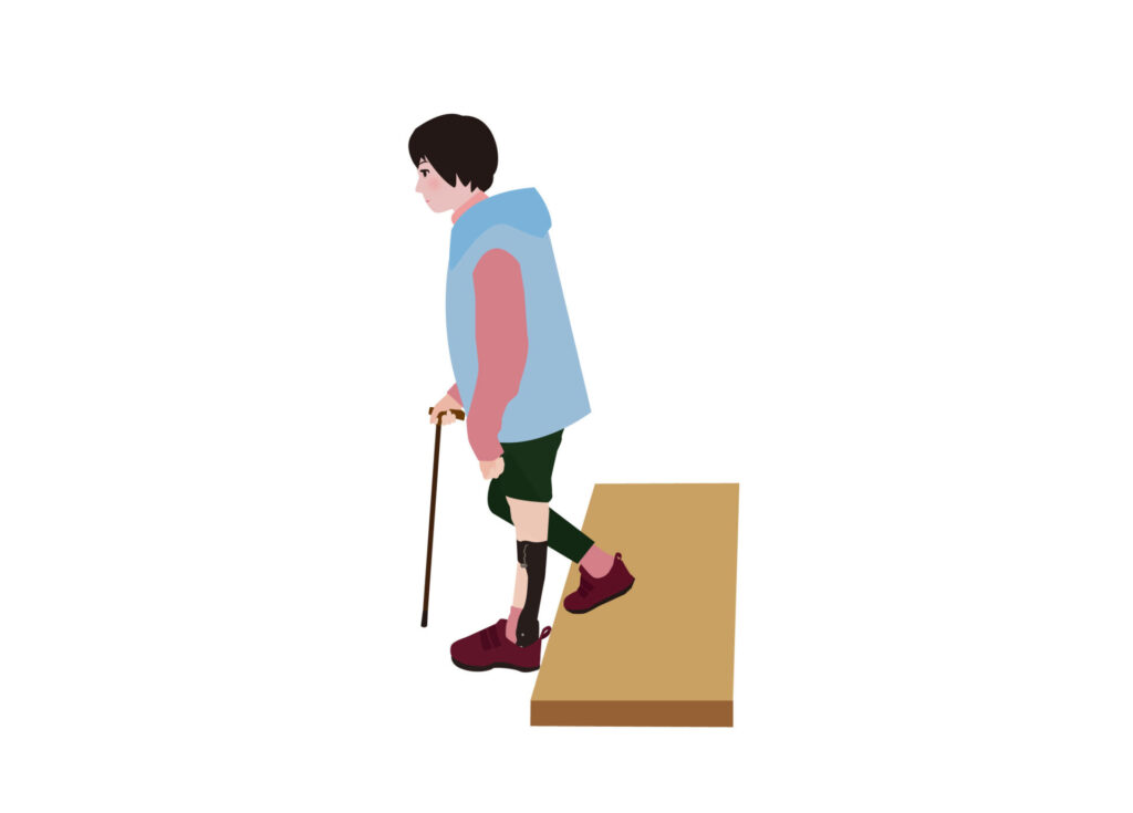 【症例も紹介】腰椎椎間板ヘルニアによる歩行障害の症状と手術の安全性